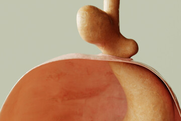 Mixed form of hiatus hernia type 3 - entrance to the stomach and protrusion of the stomach through the diaphragm - 3D rendering