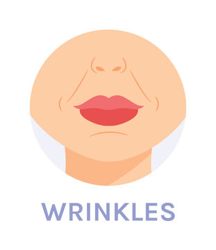 Nasolabial Facial Wrinkles. Skin Problem. Marionette Wrinkles Near the Lips. Female Nose Chin and Neck. Color Cartoon Fashion style. White background. Vector image for Beauty and Cosmetic Design.