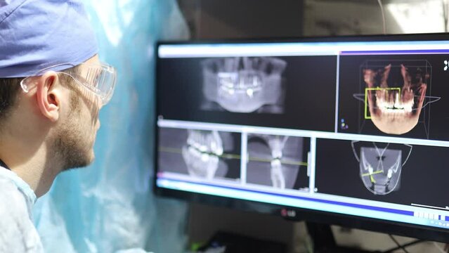 male doctor dentist examines a 3D picture of the jaw teeth on a computer.