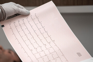 Electrocardiogram, ecg in hand, palm of a doctor. Medical health care. Clinic cardiology heart...