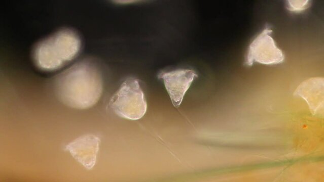 Vorticella (organism) in waste water under the microscope.