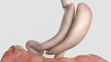 After a stomach reduction VSG - 3D rendering