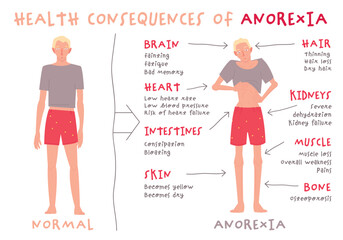 Eating disorder in men and boys. Anorexia nervosa. - obrazy, fototapety, plakaty
