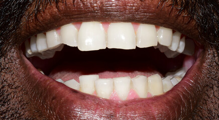 Close up shot of awesome healthy teeth smile