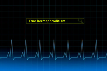 True hermaphroditism.True hermaphroditism inscription in search bar. Illustration with titled True hermaphroditism . Heartbeat line as a symbol of human disease.