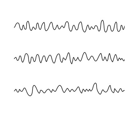 心室細動（Vf）