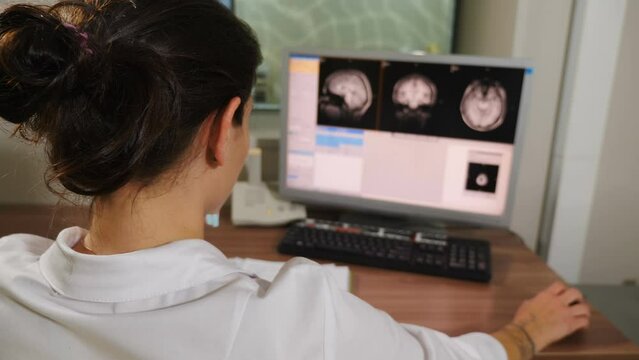 Radiologist looking at monitors with brain MRI image results in control room. Magnetic resonance, Disease diagnostics. Neurology. Oncologist Doctor Analyzes Patients. 4 k video