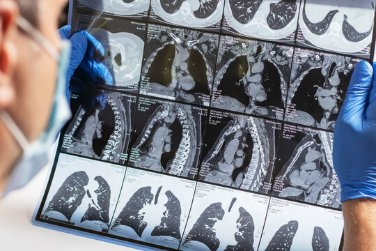 Doctor examining MRI image in hospital