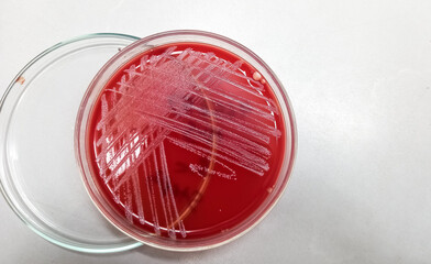 Blood agar medium growth of streptococcus, staphylococcus aureus, gram positive bacteria at medical...