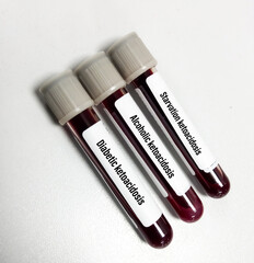 Blood sample for diabetic ketoacidosis, alcoholic ketoacidosis, and starvation ketoacidosis test. ketoacidosis test.