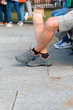 Mann sitzt auf einer Bank mit einem amputierten Bein, danehben seine Beinprothese