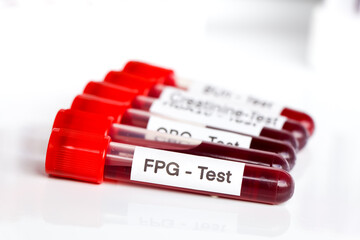 FPG-test from blood , Blood samples to be analyzed in the laboratory