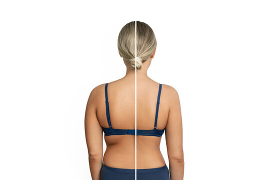 Young woman with excess fat on her back and arms and toned back before and after losing weight isolated on a white background. Result of diet, liposuction, training, healthy lifestyle