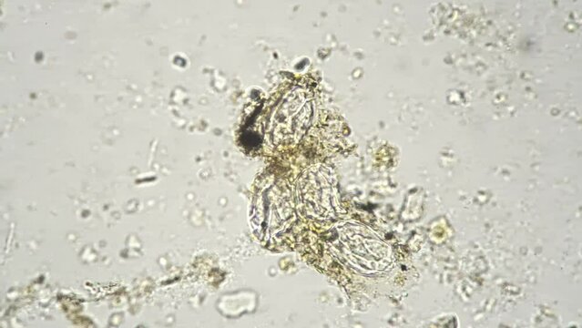 Whole mount of Taenia solium eggs under microscope on white background with 400 times magnification. Macro view of pork tapeworm on scientific slide for education. Parasites in nature. Pests concept