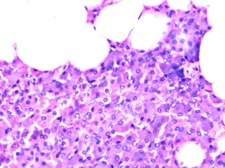 Histology of human tissue, show  epithelial tissue and connective tissue with microscope view  from the laboratory (not Illustration Designation)