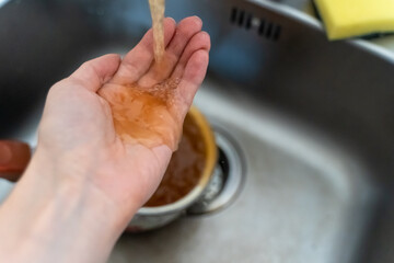Rusty orange water flows from the kitchen faucet onto a man's hand