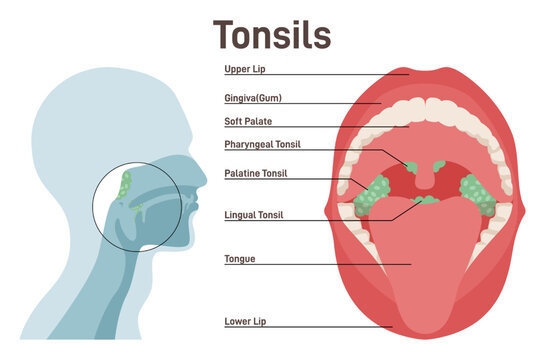 Tonsils. Human lymphoid organs. Immunocompetent organs at the back