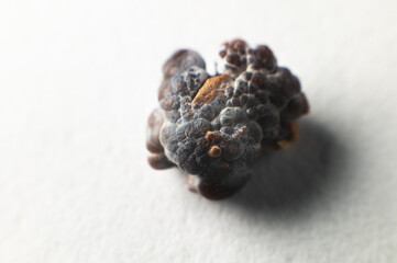 Kidney stone, intact, formed in an alkaline environment in the kidneys after ESWL intervention or...