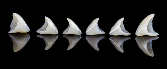 dental job photography, crowns veneers implants