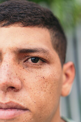 half face portrait of a man with freckles