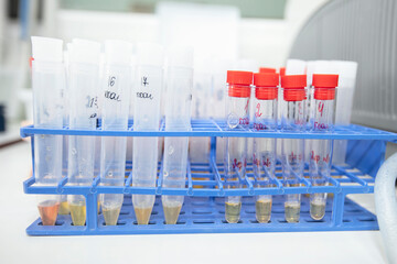 Medical test tubes with urine tests in a biochemical laboratory.