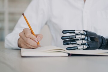 Disabled female writing with pencil in notebook, using bionic prosthetic arm, closeup. Medical tech