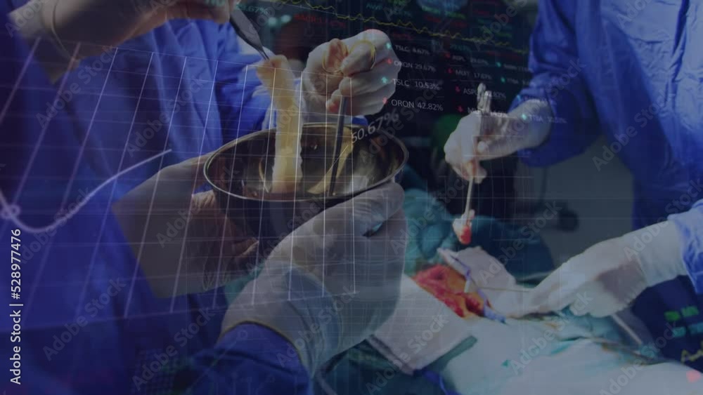 Poster animation of data processing over surgeons in operating theater