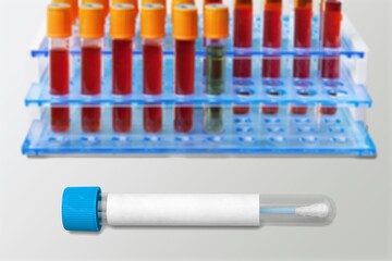 Blood sample tube for virus test. It is also known as the Moneypox virus,