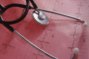 Close-up of a stethoscope on an ECG
