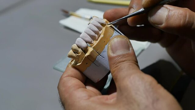 hands of a dental technician make a jaw prosthesis with front teeth. The master cleans dentures with a soft brush during work. The concept of artificial teeth