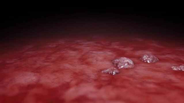 Cancer cell growth animation. Tumor growing and spreading over healthy tissue causing inflammation and metastasis. 