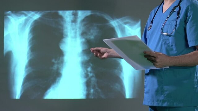 doctor examining x ray