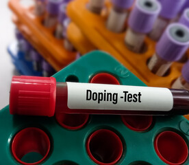 Blood for doping drugs test. Doping is the used of banned athletic performance enhancing drug by athlete in competitive sport. Medical test.