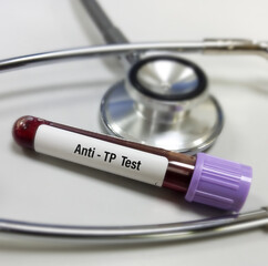 Blood sample for Anti-TP(Treponema pallidum) test. Diagnosis Syphilis infection. STDs, STI.