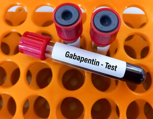 Blood sample for Gabapentin level test. Set therapeutic dose. Epilepsy, seizures.