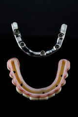 top view of the upper jaw prosthesis made of zircon and titanium beams on a black background © Dental Pro Content