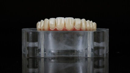 cuvette with silicone and dental prosthesis of the upper jaw made of ceramic and titanium on a black background © Dental Pro Content