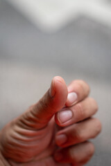 Knife cut mark on the human hand thumb finger. Healthcare and accident abstract photo, selective...