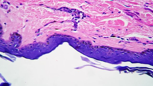 Microscope image of human skin with sweat glands magnified in 400 times against bright field. Macro footage of epidermis layers for analyzing men perspiration process. Laboratory investigation
