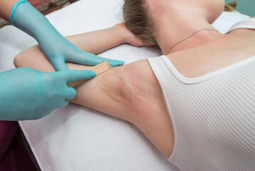 Depilation and epilation of the female armpit with liquid sugar paste. The beautician's hand applies wax paste to the armpit.