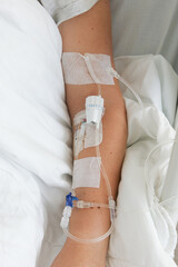 woman arm of intubated patient in hospital