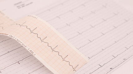 ekg paper showing ECG results on a white background