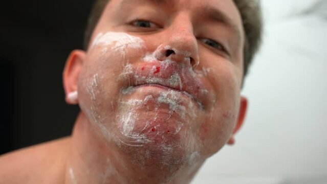 Handsome man suffering from skin irritation after shaving, male showing blood cuts and irritation on camera. Guy shaving with razor applying moisturizing foam on face skin. Daily hygiene, masculinity