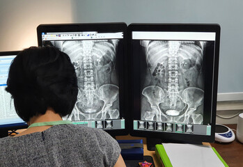X ray doctor examines the patient's x ray film