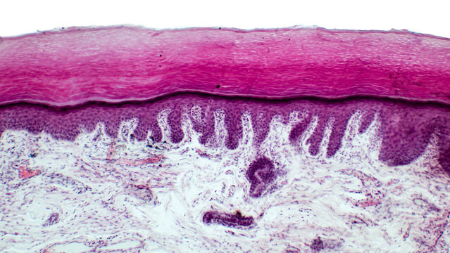 Human skin. Light micrograph of epithelial tissue from the skin. Human finger section showing epidermis (stratified squamous epithelium), dermis and connective tissues. Hematoxylin and Eosin Staining.