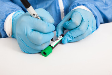 Closeup of a nurse labelling a test tube with blood sample in a clinical laboratory