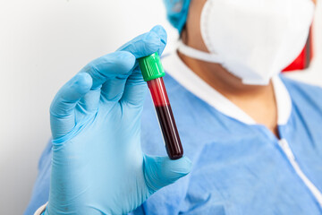 Closeup of a test tube with blood sample been hold by a female in a clinical laboratory