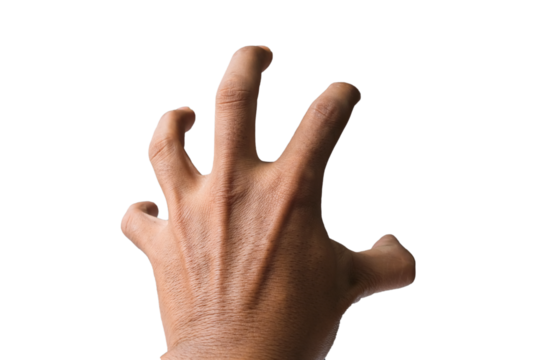 Blood vessels in man's hand with clipping path on white background for health care concept