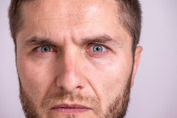 Obraz premium Angry, nervous, doubtful, unhappy, frustrated man frowning his eyebrows. Annoyed closeup face portrait.
