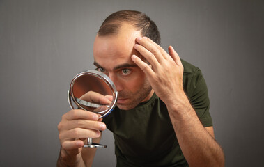 Man looking at mirror. Hair loss concept